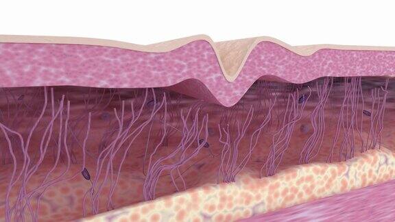减少皱纹的治疗抗衰老护肤医学三维动画
