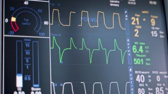 手术室手术过程监控屏幕有现代设备的急救室能显示病人的生命体征