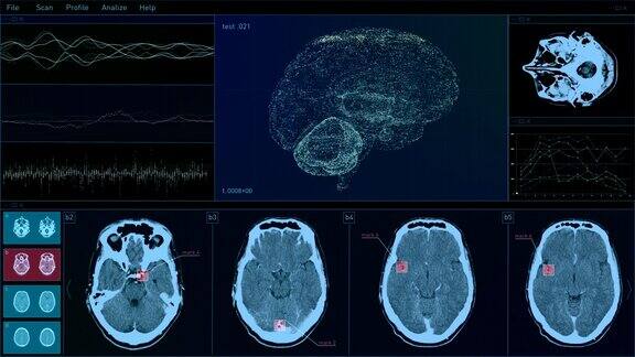 数字技术用户界面大脑扫描