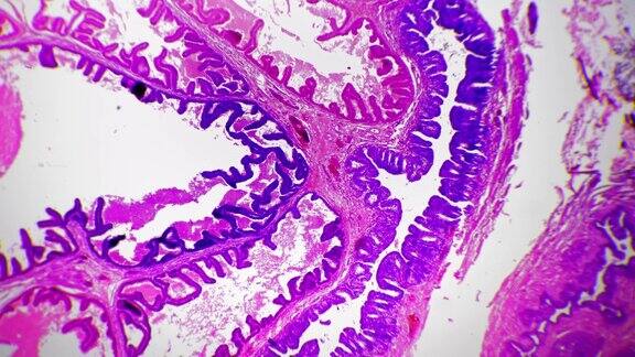 人前列腺对亮场切片显微镜放大100倍