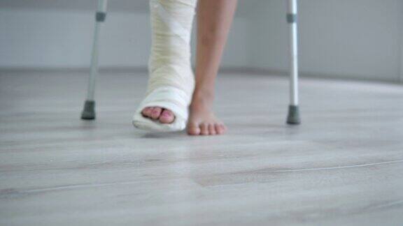用拐杖走路时用石膏打石膏的女性断腿特写腿部受伤后的康复概念