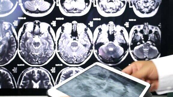特写医生回顾病人的大脑扫描数字平板电脑