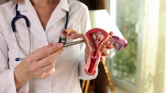 妇科医生用笔指着子宫和卵巢的解剖模型