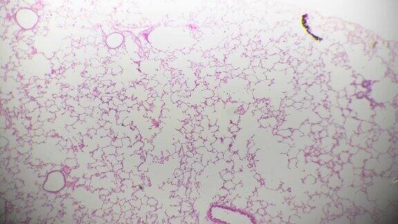 在明亮背景下40倍显微镜下人体肺组织的宏观切片