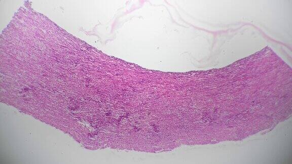 在40倍显微镜下观察人体动脉切片