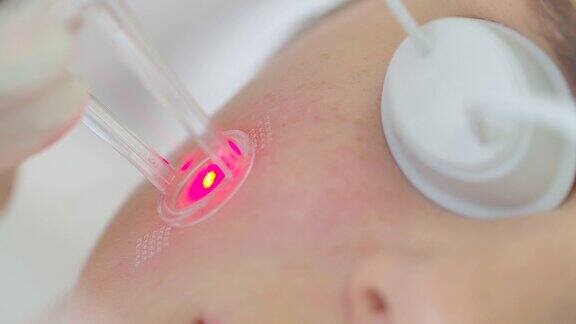 用激光修整面部皮肤现代创新医疗设备美容诊所的激光面部抛光