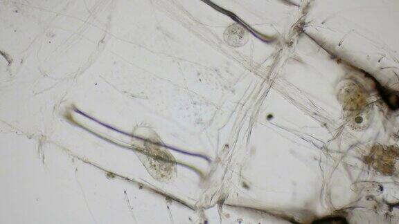 纤毛草履虫在显微镜下为4k
