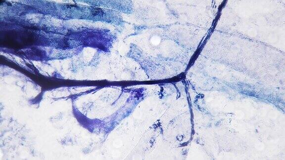 在200x显微镜下拍摄的整个人体运动神经末梢