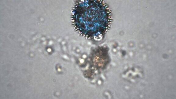 在显微镜下放大类似于冠状病毒covid-19病毒的圆形蓝色细胞