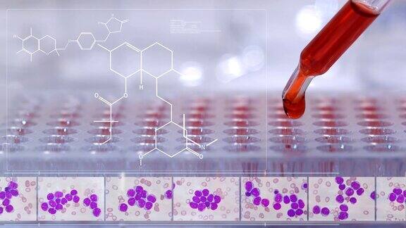 白血病疾病药物全息图药物化学结构的未来技术为患者