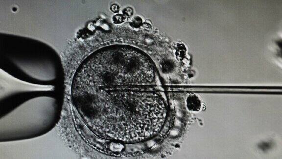 胞浆内精子注射体外受精的显微镜观察胚胎学家进行精子注射试管受精4k的视频