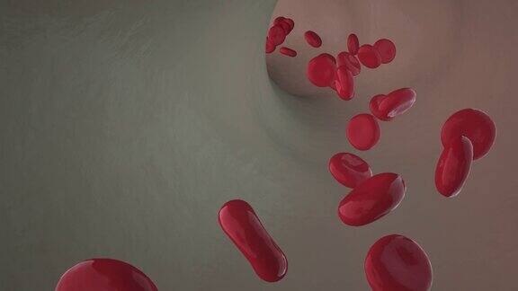 人类的血液系统描绘血管内形成的血凝块3d动画