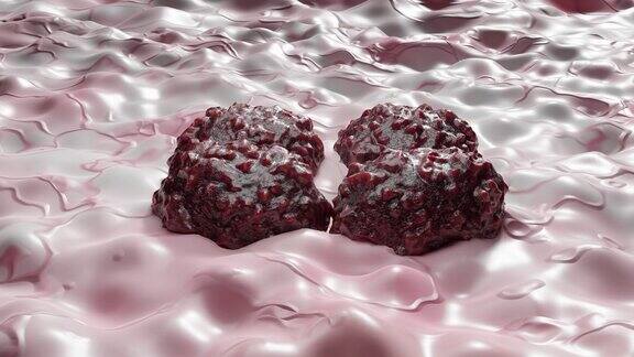 肿瘤细胞在组织内不受控制地生长肿瘤感染细胞并扩散浸润性炎症转移癌复制繁殖细胞扩张黑色素瘤癌症3d渲染
