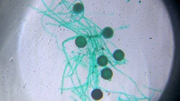 显微镜下的黑根霉