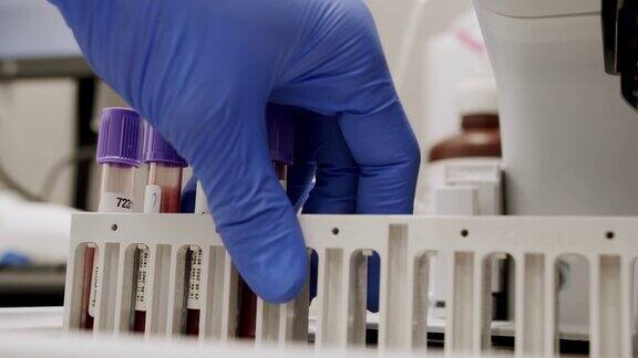自动化机器在工作过程中血液和尿液样本分析