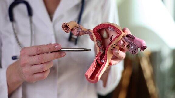 妇科医生持有女性生殖器官的解剖模型