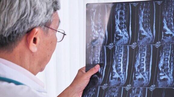 亚洲资深男医生正在深入分析x光片的治疗效果