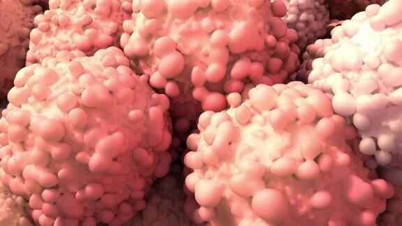 肿瘤一组形成生长的异常细胞
