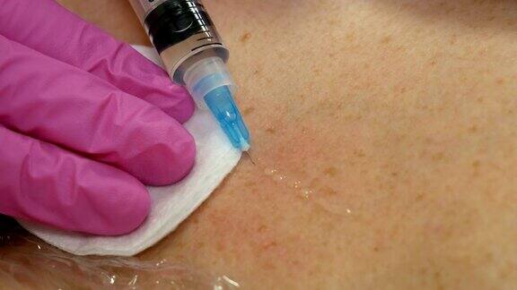 英俊的女人有注射在颈部和胸部皮肤的程序使医生在粉红色的手套中间疗法