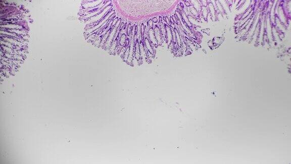 在医院实验室40倍医用显微镜下拍摄的人结肠切片