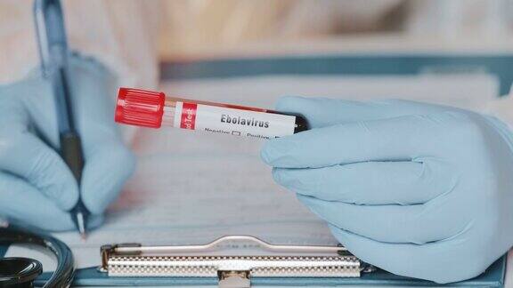 医生手握化验阳性的埃博拉病毒血液试管