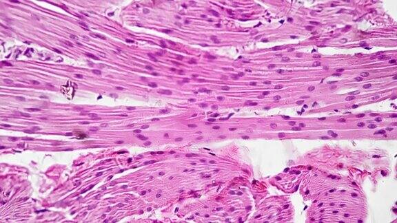 人膀胱在400倍显微镜下切片用于医学分析