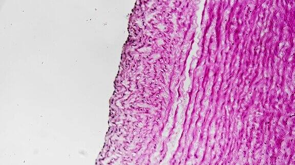 实验用人体大动脉形态在200倍显微镜下放大