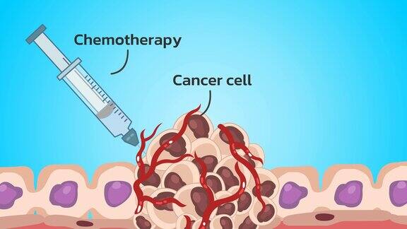 癌细胞和化疗的破坏