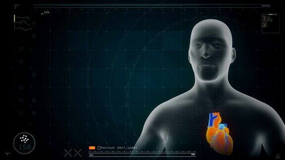 患者心脏可视化模型在屏幕上旋转监控软件
