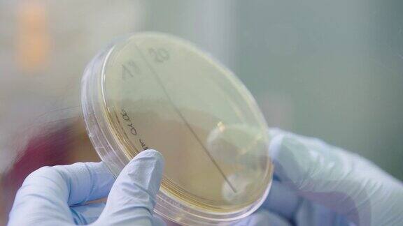 科学家手里拿着装有细菌的培养皿