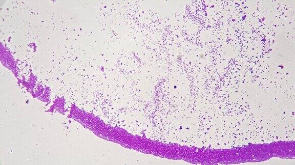 大肠杆菌涂片在200x科学玻片显微镜下明亮的视野背景
