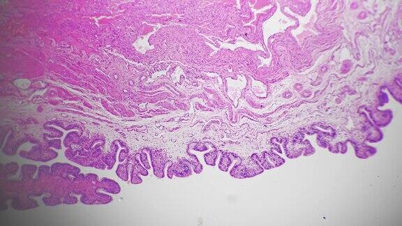在明亮背景下显微镜放大40倍的人阴道切片