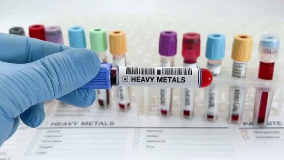 实验室技术员拿着一份血液测试而不是重金属测试的申请报告