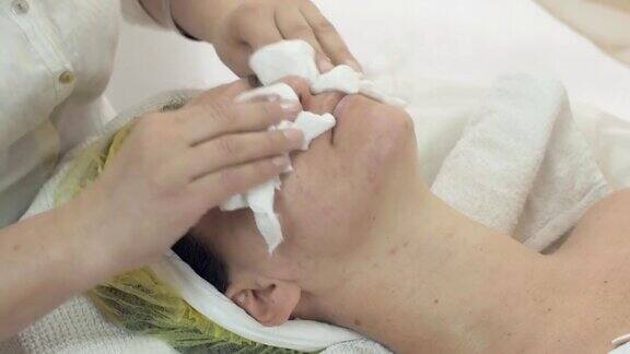 美容师在美容院用餐巾纸擦拭女性面部问题肌肤