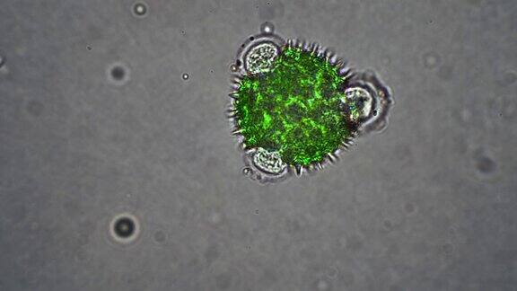 冠状病毒的绿色细胞在显微镜下是足部的花粉细胞
