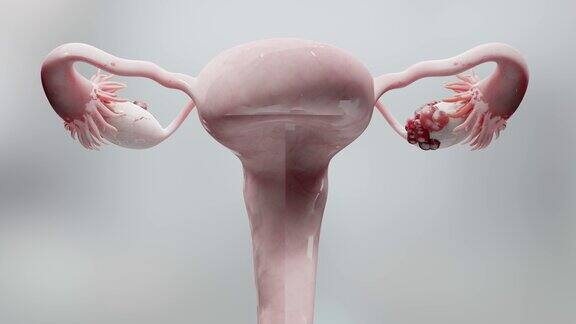 卵巢恶性肿瘤女性子宫解剖生殖系统癌细胞卵巢囊肿宫颈癌生长细胞妇科疾病转移癌复制3d渲染