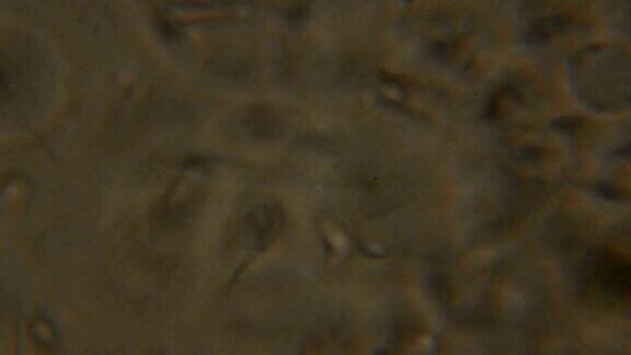 在显微镜下观察的精子在相衬显微镜下移动的人类精子特写显示精子在显微镜下录像精液4kUHD