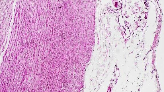 实验取人体大动脉形态显微镜下放大100倍