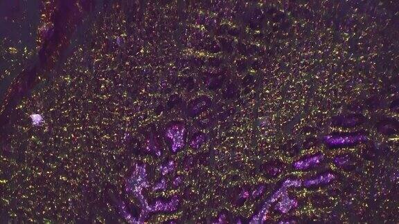 人胃切片在400倍显微镜下倾斜照明下拍摄