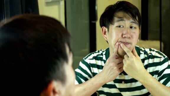 年轻的亚洲男人与痤疮肖像少年男子照镜子挤青春痘护肤生活理念