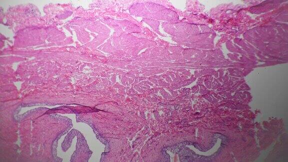 40倍显微镜下人体膀胱切片用于医学分析