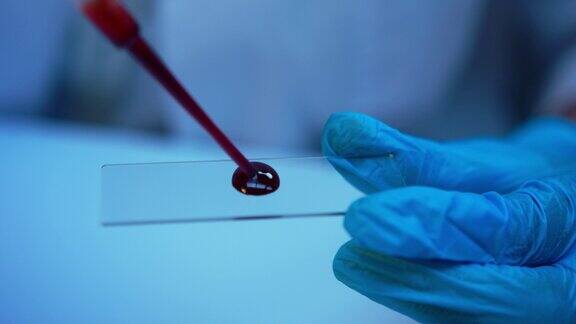 显微镜载玻片上的一滴血
