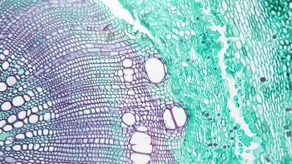 显微镜下显示双子叶木本植物茎的横切面科学样本