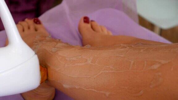 女性腿部脱毛激光治疗美容沙龙