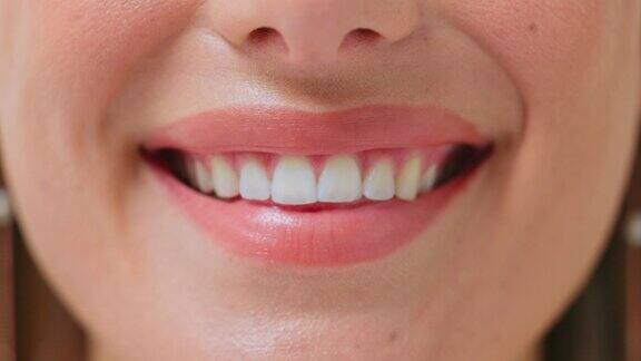 快乐牙齿和特写微笑的女人为医疗或牙齿健康的结果口腔、健康、嘴唇和口腔卫生的个人或牙医病人显示美白或治疗进展
