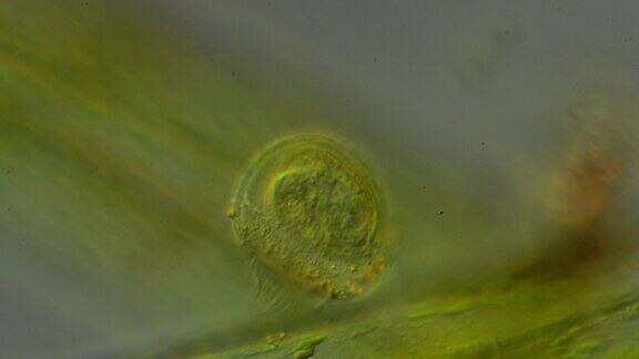 显微镜的钟形虫