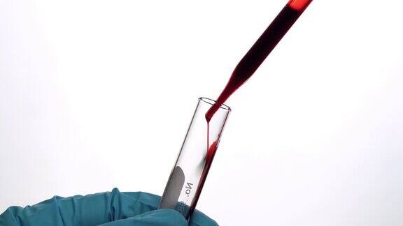 血液滴入试管血液测试概念