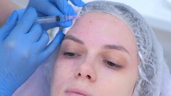 美容师对女孩额头皮肤进行多次注射生物活化