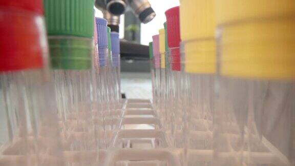塑料试管与液体在实验室的特写