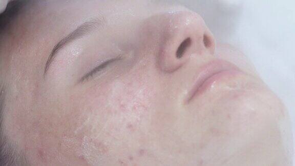 闭着眼睛的年轻女子的特写肖像脸上有热蒸汽治疗痤疮问题治疗